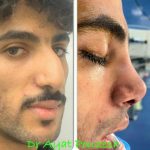 دکتر آیت پوزش در شیراز