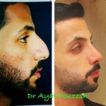 دکتر آیت پوزش در شیراز