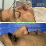 دکتر آیت پوزش در شیراز