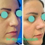 دکتر آیت پوزش در شیراز