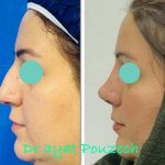 دکتر آیت پوزش در شیراز