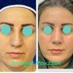 دکتر آیت پوزش در شیراز