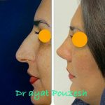 دکتر آیت پوزش در شیراز