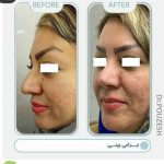 دکتر آیت پوزش در شیراز