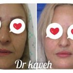 دکتر فرهاد کاوه در کرج