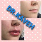 دکتر فرهاد کاوه در کرج